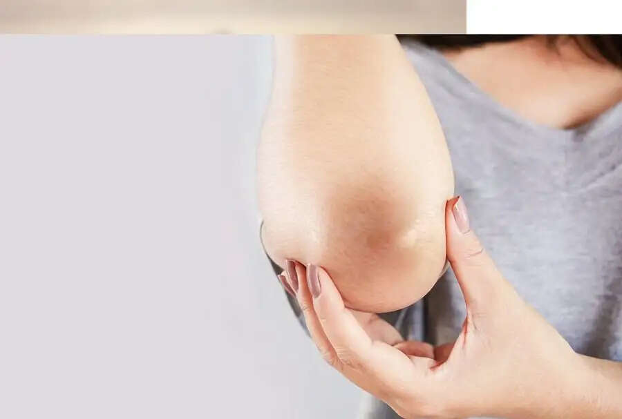 Skin Care Tips-&nbsp;क्या काली कोहनी से हो जाते हैं शर्मिंदा, जानिए इसको साफ करने के तरीके