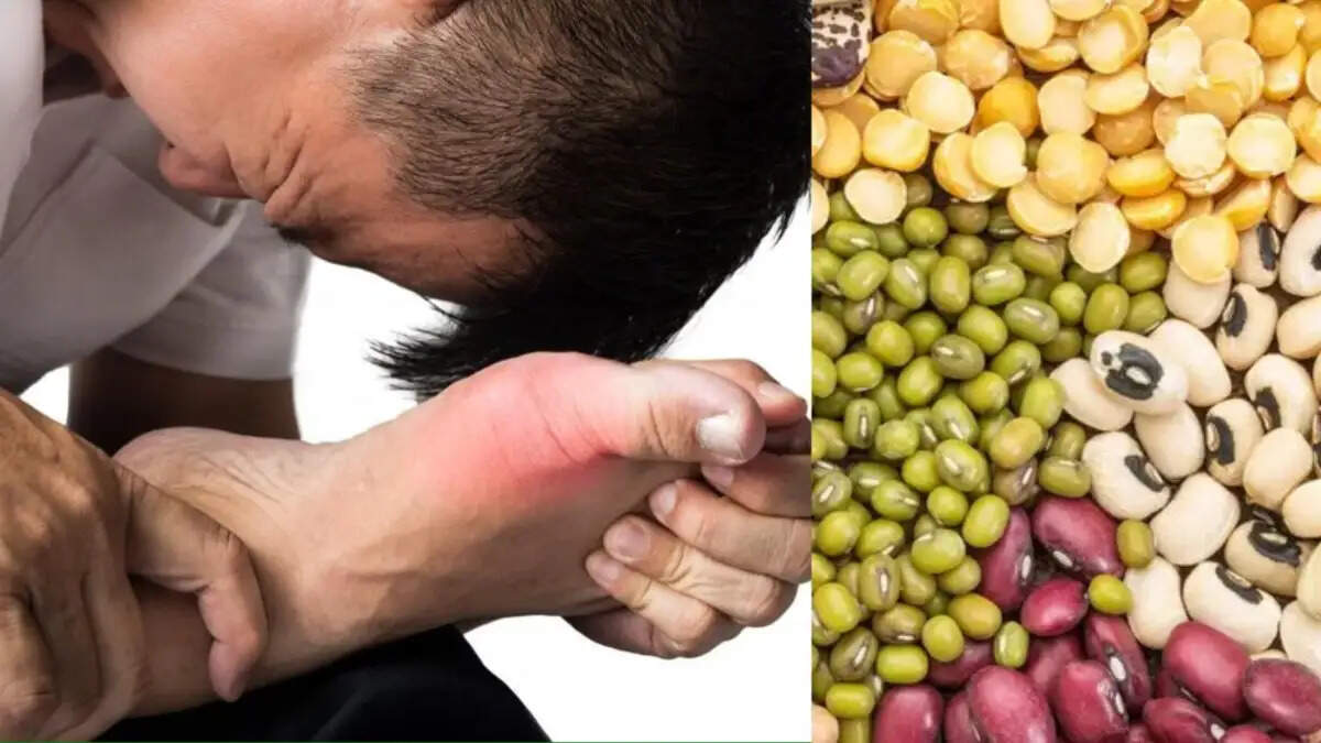 Health Tips-यूरिक एसिड़ से ग्रसित लोगो को भूलकर भी नहीं खाने चाहिए ये फूड्स, जानिए इनके बारे में