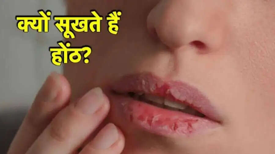 Lip Care Tips-  क्या आपके होंठ बार बार फट रहें हैं, तो इस विटामिन की शरीर में हो गई कमी