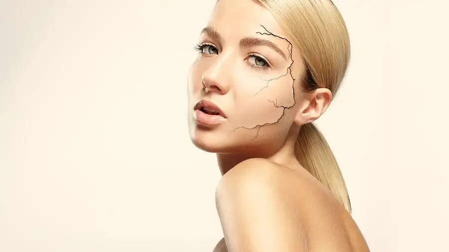 Skin Care Tips-&nbsp;सर्दी ने स्कीन को बना दिया हैं ड्राई, तो अपनाए ये घरेलू नुस्खें