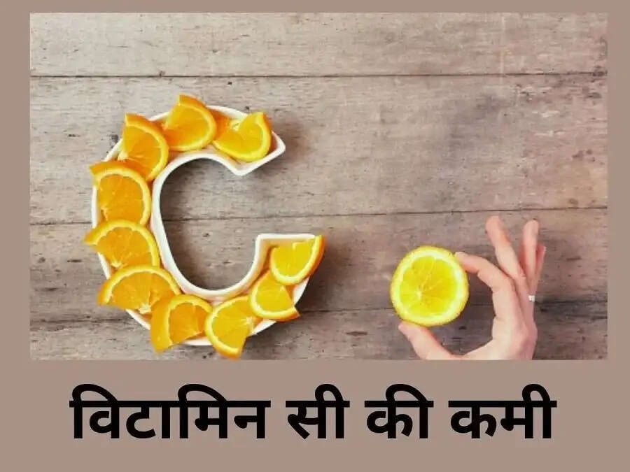 Health Tips-  क्या शरीर में हो गई हैं विटामिन सी कमी, तो ऐसे करें इसकी पूर्ती
