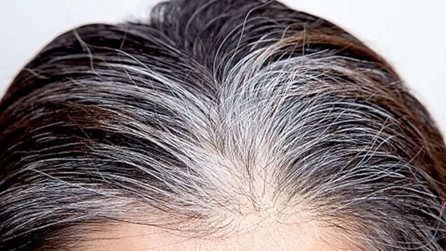 Hair Care Tips- सफेद बालों पर महंगा कलर नहीं, हीना पाउडर युक्त ये पेस्ट लगाए