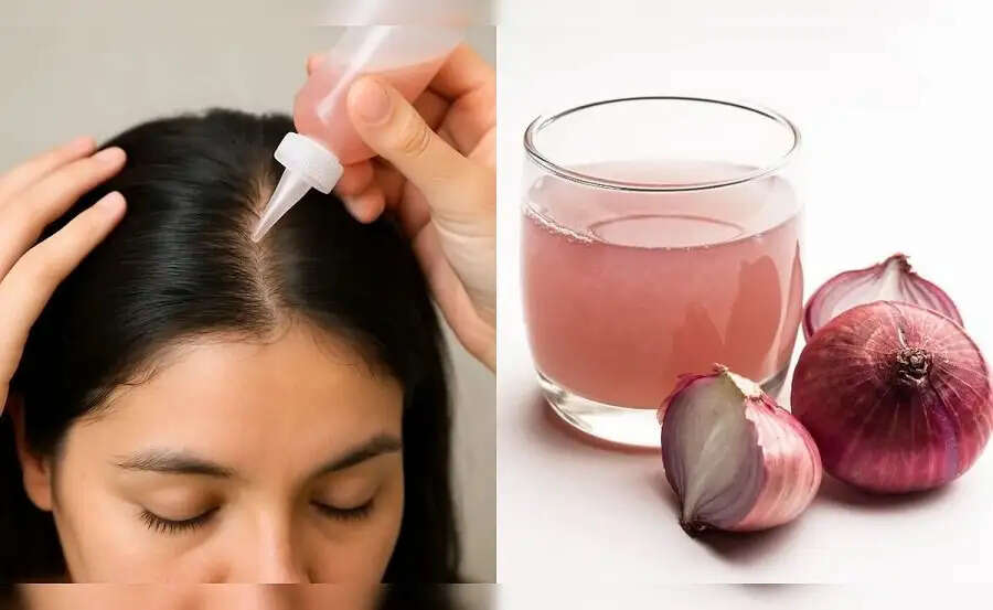 Hair Care Tips-&nbsp;बालों में ज्यादा प्याज लगाना हो सकता हैं नुकसानदायक, जानिए हफ्ते में कितनी बार लगाना चाहिए प्याज का रस