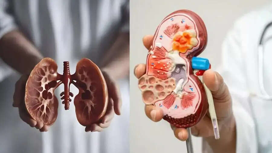 Health Tips-किडनी के मरीज भूलकर भी ना करें इन चीजों का सेवन, स्वास्थ्य के लिए होती हैं हानिकारक