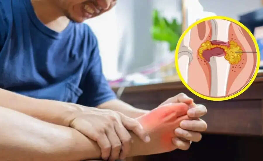 Health Tips-&nbsp;शरीर जमा यूरिक एसिड को इन ड्रिंक्स की मदद निकाले बाहर, जानिए इनके बारे में