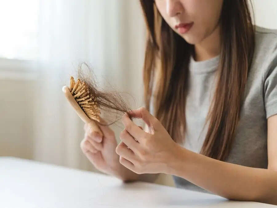 Hair Care Tips- इन आदतों की वजह से गंजे हो सकते हैं आप, भूलकर भी ना करें ये गलतियां