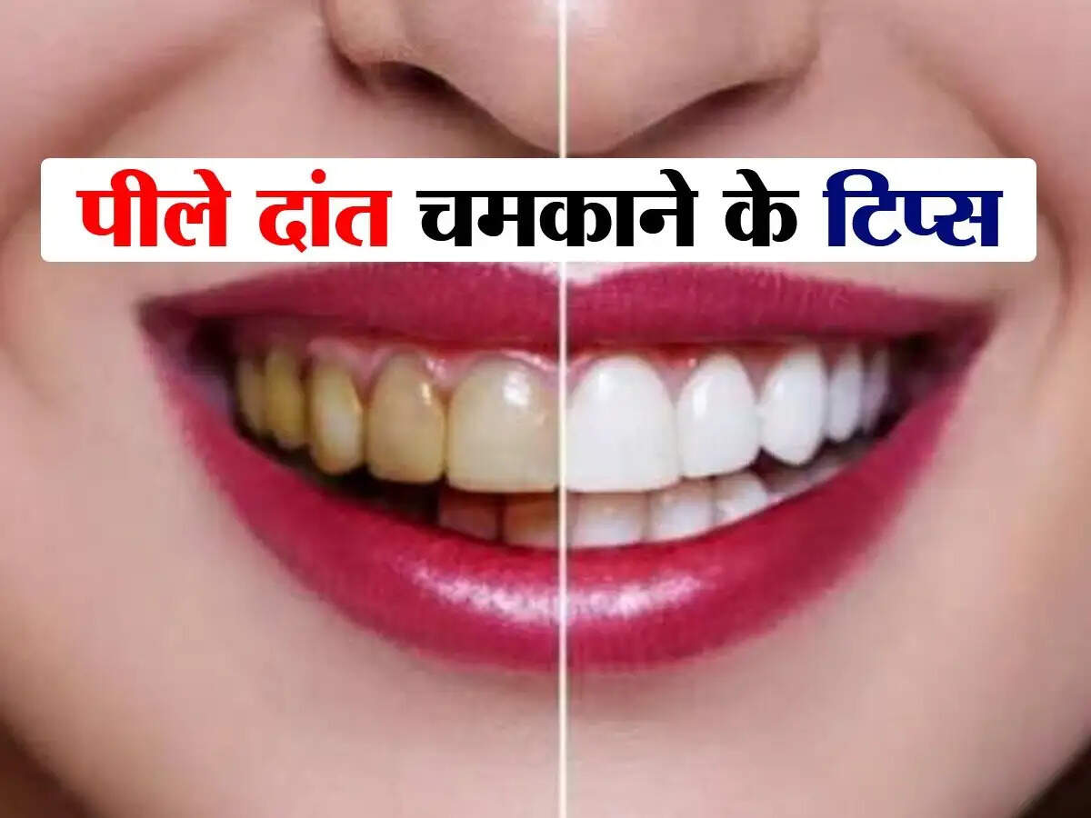 Teeth Care Tips- क्या आप पीले दातों से परेशान हैं, दातों को चमकाने के लिए इस फल के छिलको का करें इस्तेमाल