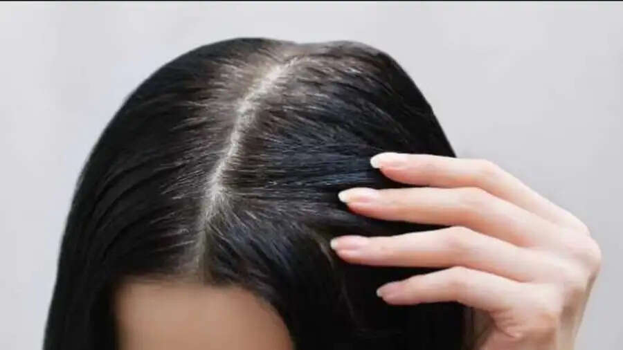 Hair Care Tips-&nbsp;सफेद बालों ने कर रखा हैं परेशान, काला करने के लिए सरसों के तेल इन चीजों को मिलाकर लगाएं
