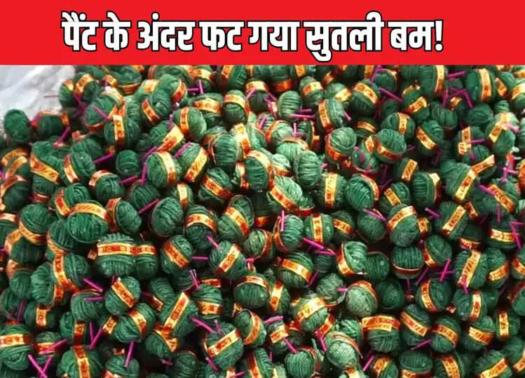 जेब में सुतली बम लिए घूम रहा था लड़का, अचानक लगी आग, प्राइवेट पार्ट का हुआ ये हाल!