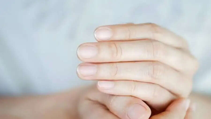 Health Tips-&nbsp;अगर नाखनों में दिखाई दे ये लक्षण, तो भूलकर भी ना करें इग्नोर
