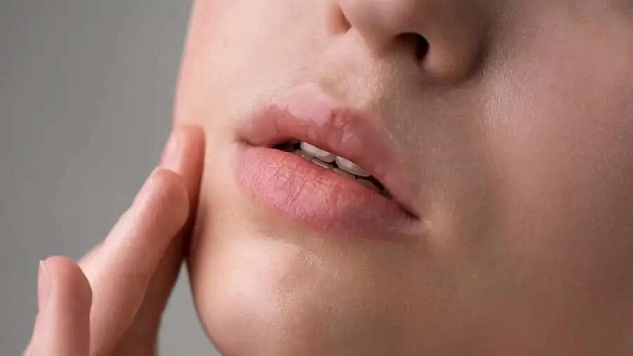 Lips Care Tips-&nbsp;क्या सर्द मौसम की वजह से होँठ रूखें और फट गए हैं, ऐसे रखें इनका ख्याल