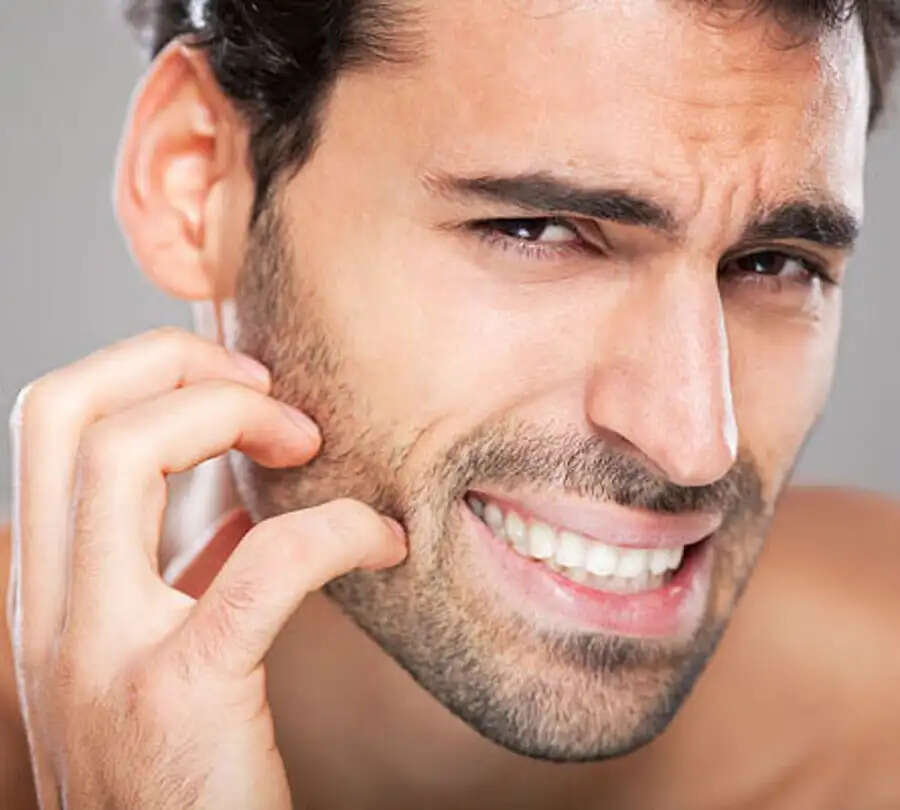Hair Care Tips-&nbsp;क्या गर्मी की वजह से दाढ़ी में चल रही है खुजली, जानिए इससे छुटकारा पाने के टिप्स
