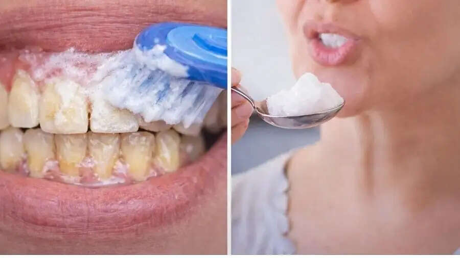 Teeth Care Tips- क्या दांतों के दर्द से परेशान हैं, इन घरेलू नुस्खों को अपनाएं