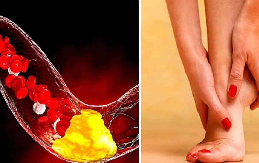 Health Tips-&nbsp;शरीर में बढ़ गया हैं कोलेस्ट्राल, तो पैरों में होने लगती हैं ये दिक्कतें