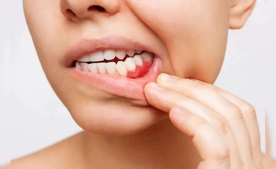 Teeth Care Tips- क्या आप जबड़े के दर्द से परेशान हैं, जानिए इसके उपाय