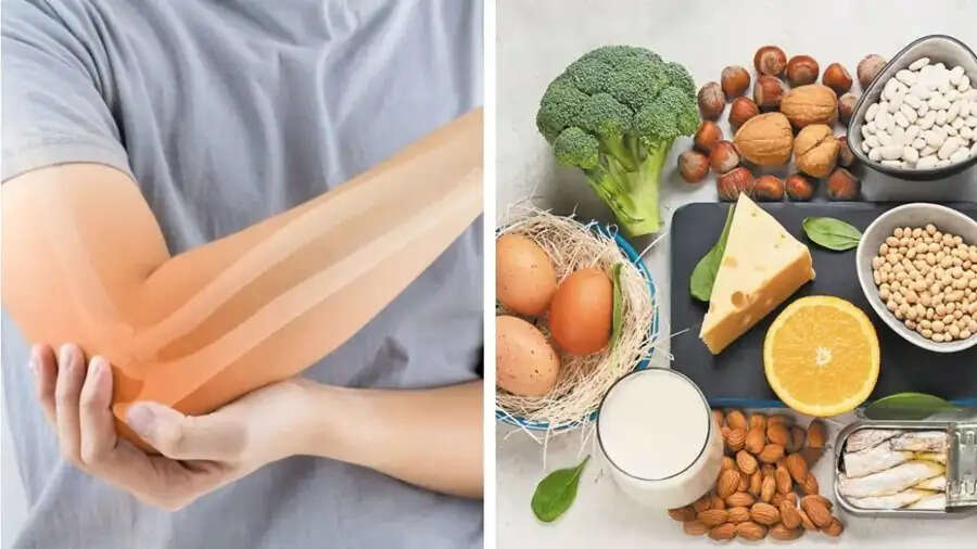 Health Tips-  क्या बढ़ती उम्र के कारण हड्डियां हो गई हैं कमजोर, आहार में शामिल करें ये सुपरफूड्स