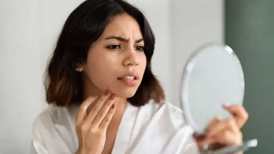 Skin Care Tips-&nbsp;ठंड के मौसम में स्किन बेजान और रूखी हो गई है, तो ऐसे रखें स्किन का ख्याल