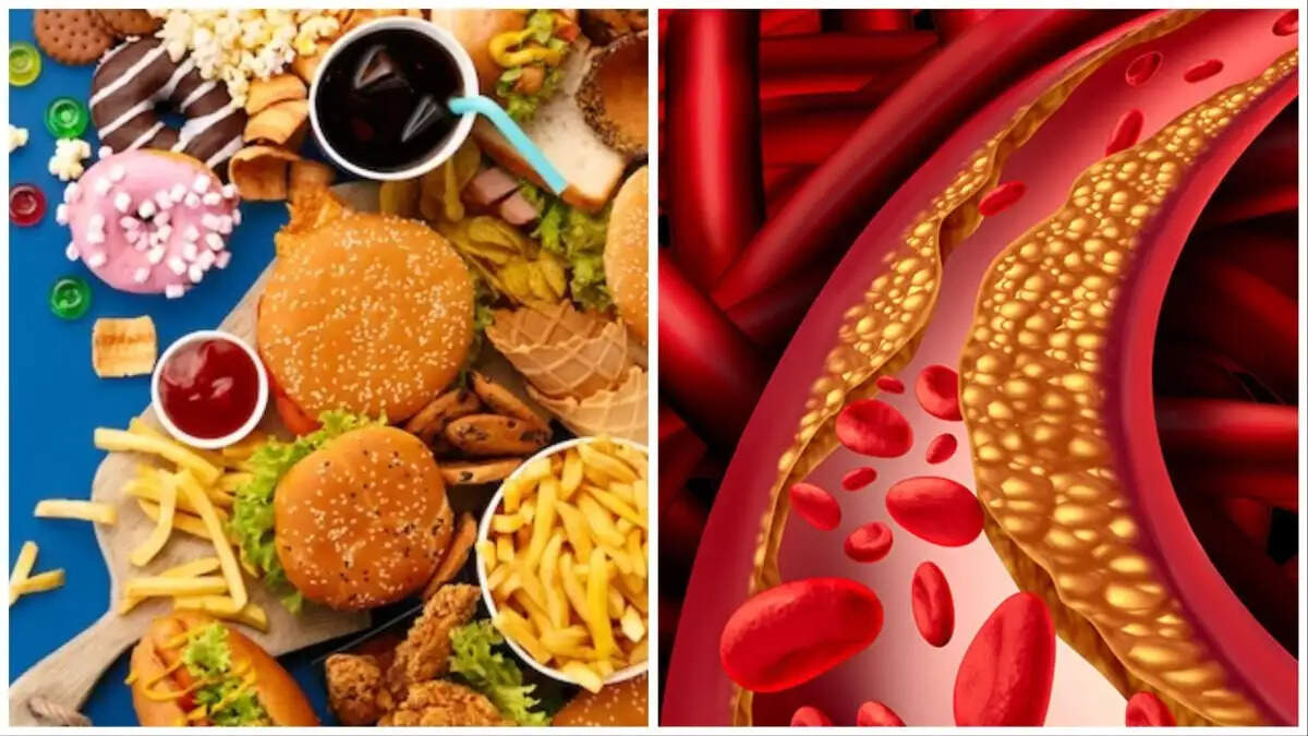 Health Tips- शरीर में बढ़ाना हैं गुड कोलेस्ट्रॉल, तो इन चीजों का करे सेवन