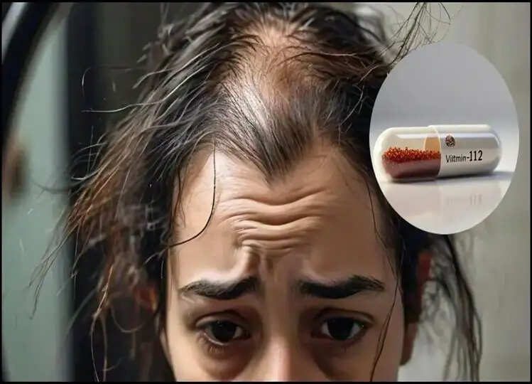 Vitamin B12 की कमी से बालों पर दिखाई देने लगते हैं ये संकेत, क्लिक कर जानें