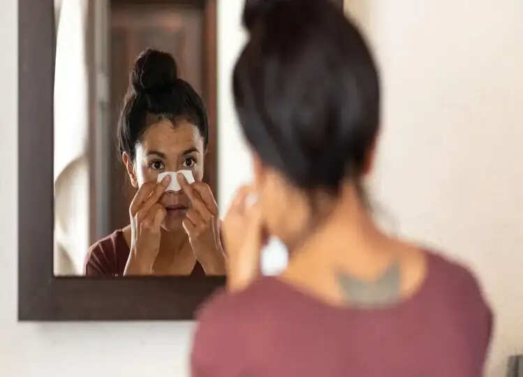 Beauty: ब्लैकहेड्स से छुटकारा पाने के लिए आप भी आजमाएं ये उपाय, बेहद हैं कारगर