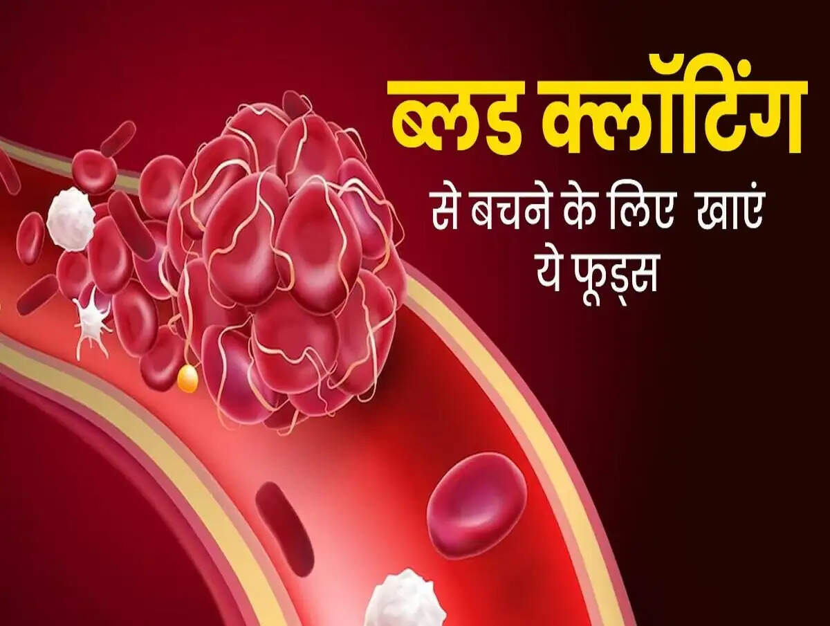 Health Tips- ब्लड क्लॉटिंग से बचने के लिए आज ही करें ये काम, जानिए पूरी डिटेल्स