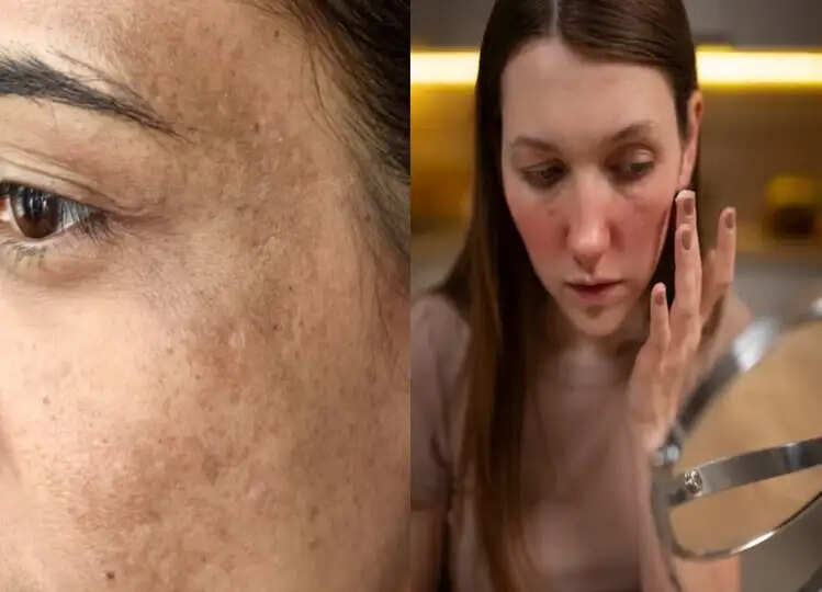 Beauty: रात को सोते समय चेहरे पर दो बूँद लगा लें ये तेल, मिलेगी ऐसी चमक कि चांद भी नजर आएगा फीका