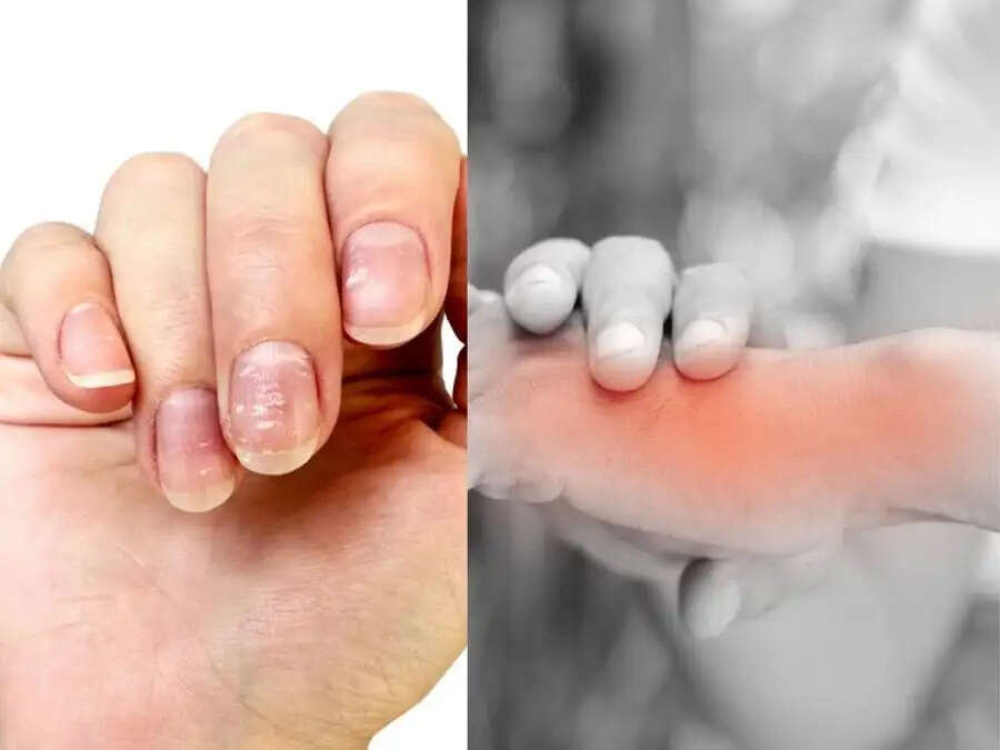 Health Tips- शरीर में कैल्शियम की कमी होने पर दिखाई देते हैं ये लक्षण, जानिए पूरी डिटेल्स