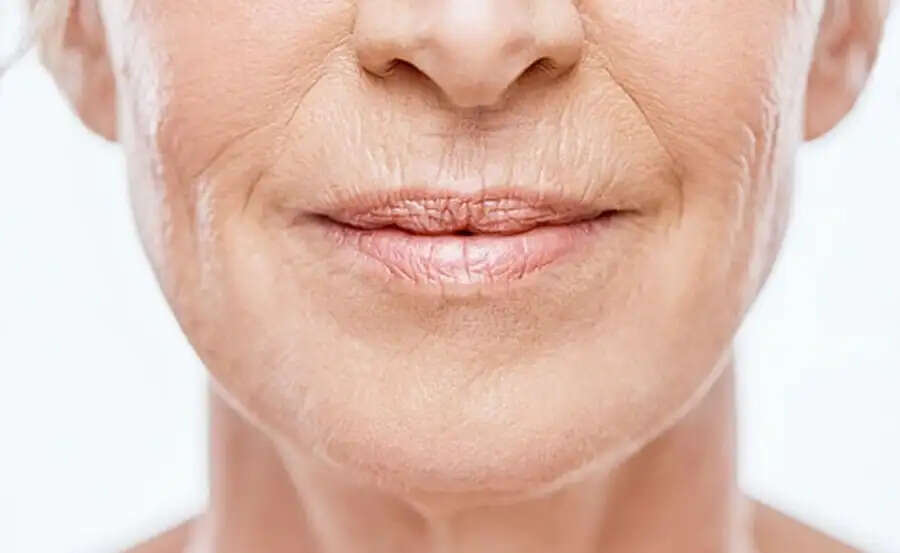 Skin Care Tips- क्या चेहरे पर होने वाली झुर्रियों ने कर रखा हैं परेशान, कम करने के लिए अपनाएं ये घरेलू उपाय