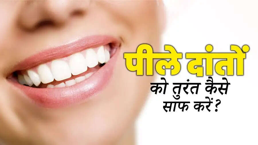 Teeth Care Tips- क्या पीले दांतों की वजह से होना पड़ता हैं शर्मिंदा, साफ करने के लिए अपनाएं ये घरेलू उपाय