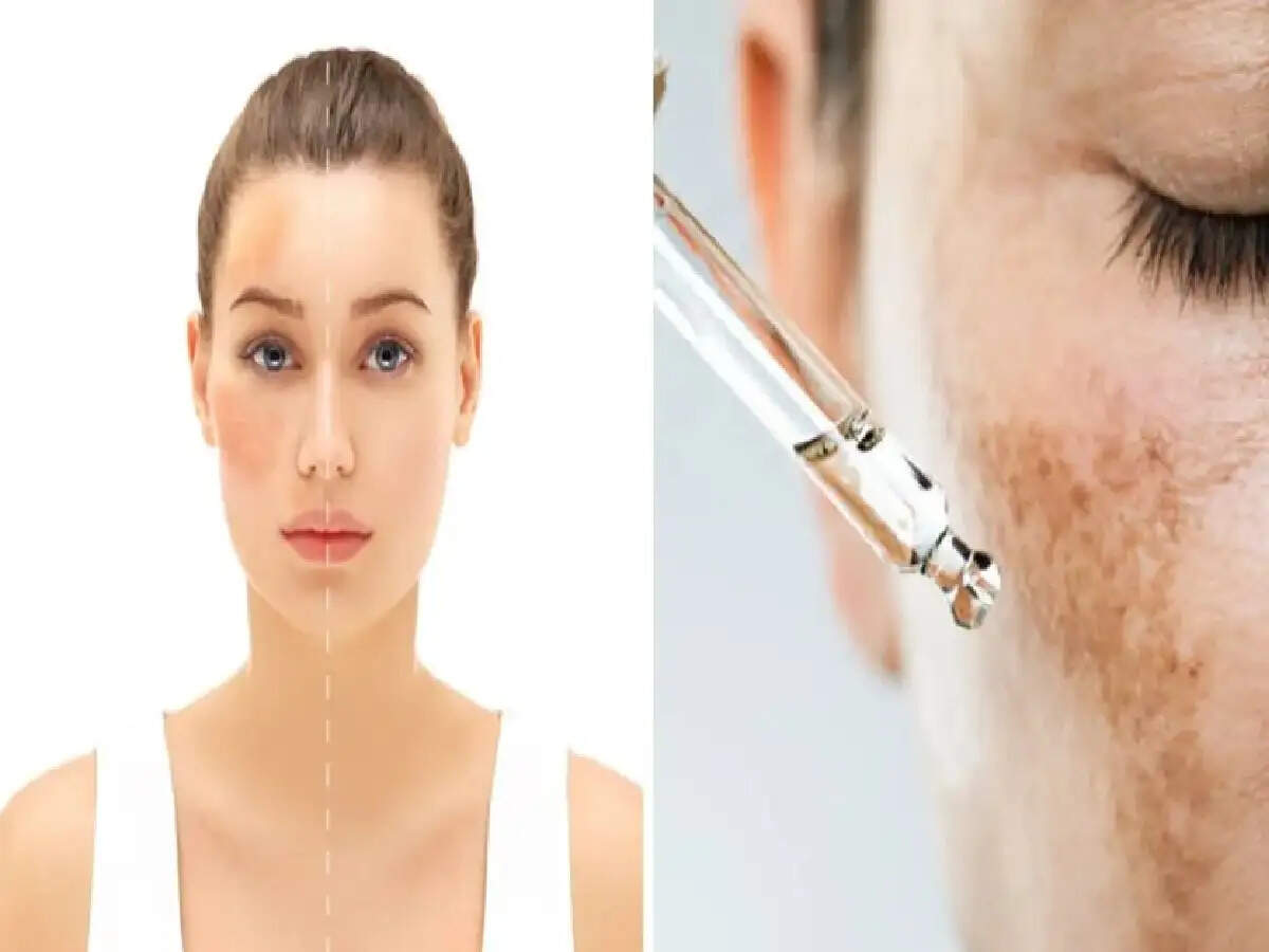 क्या आपका चेहरा अचानक काला पड़ गया है? लिवर से जुड़ी समस्याएं होने पर स्किन में दिखते हैं ये बदलाव, जानें घरेलू उपाय