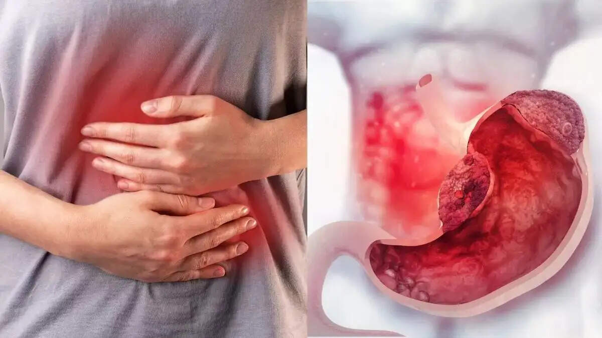 Health Tips- पेट का कैंसर बन रह हैं युवाओं के बीच बड़ी समस्या, जानिए इसके कारण