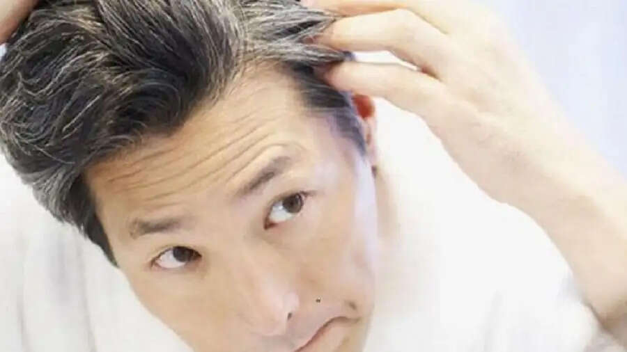 Hair Care Tips-&nbsp;क्या बाल उम्र से पहले सफेद हो गए हैं, जानिए इसका कारण