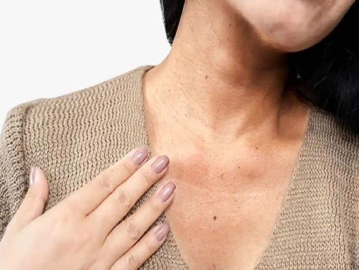 Dark Neck Skin: गर्दन के आस-पास हैं काले धब्बे? इन्हें नज़रअंदाज़ न करें, इन गंभीर बीमारियों के हो सकते हैं शुरुआती लक्षण