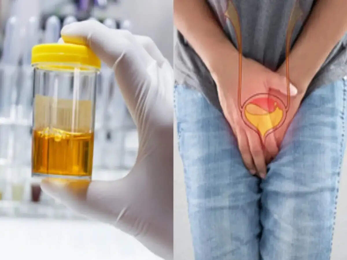 Urine Color- आपके पेशाब का रंग बताता हैं आपकी सेहत कैसी हैं, आइए जानें पूरी डिटेल्स