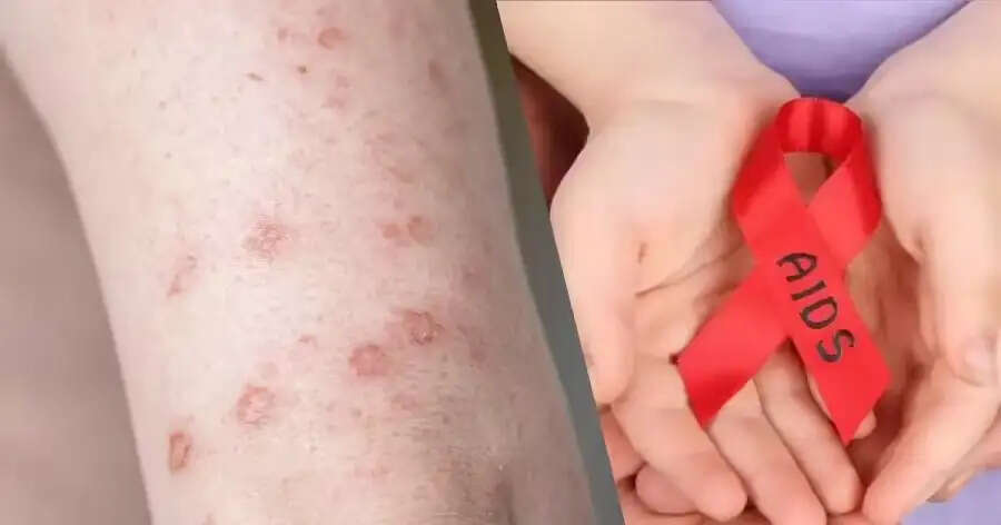 Health Tips-&nbsp;HIV&nbsp;से ग्रसित लोग कर सकते हैं ये काम, सावधानी हैं जरूरी