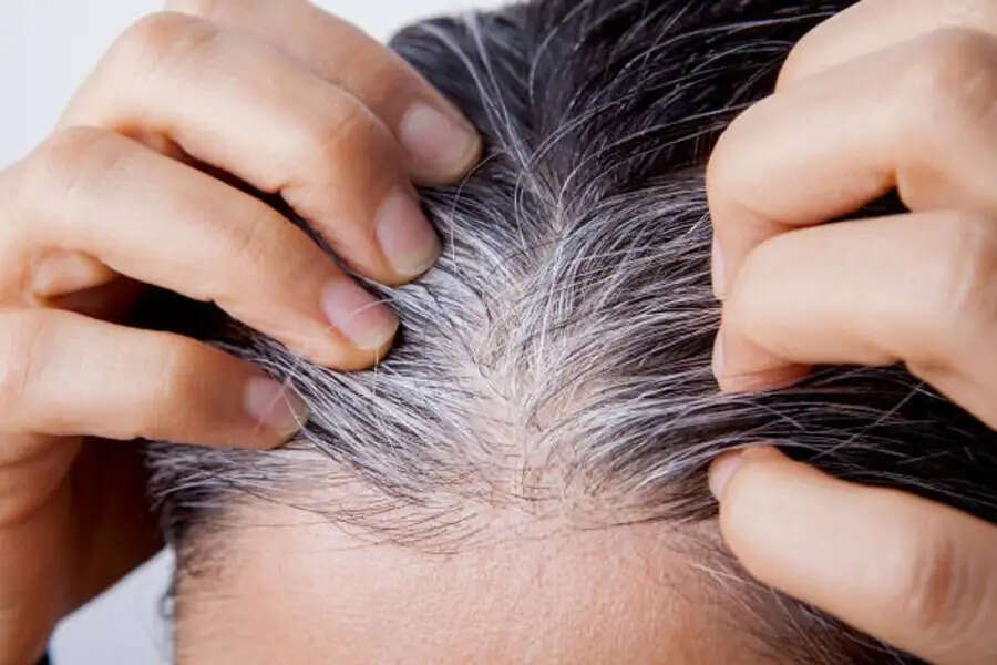 Hair Care Tips- क्या छोटी उम्र में ही बाल सफेद होने लग गए हैं, जानिए इसका कारण