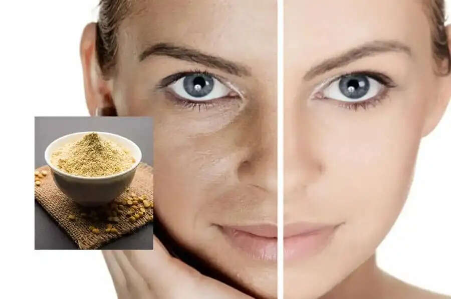 Skin Care Tips-&nbsp;स्किन को बेदाग और ग्लोइंग बनाने के लिए नींबू और दही का करें ऐसे इस्तेमाल, जानिए पूरी डिटेल्स