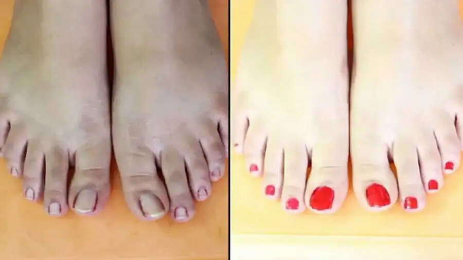 Skin Care Tips-&nbsp;क्या पैरों के कालेपन से होना पड़ता शर्मिंदा, साफ करने के लिए अपनाएं ये घरेलू उपाय