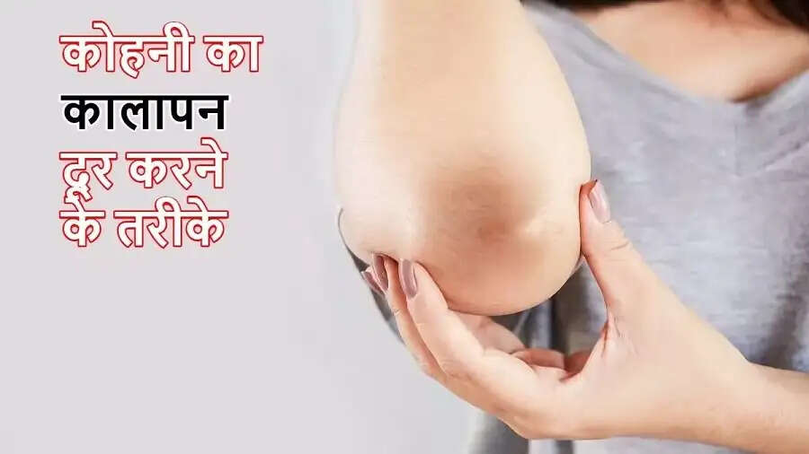 Skin Care Tips-&nbsp;क्या कोहनी के कालेपन से परेशान हैं, साफ करने के लिए अपनाएं ये टिप्स