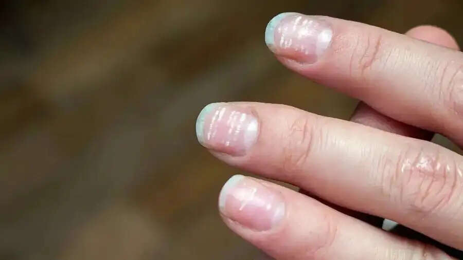 Nails Care Tips-&nbsp;क्या आपके नाखून बार बार टूट रहे हैं, तो करें ये काम