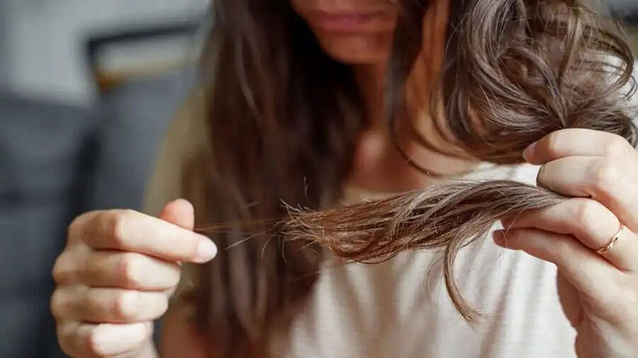 Hair Care Tips-&nbsp;सर्दियों में इस वजह से बढ़ जाता हैं हेयर फॉल, आइए जानते हैं बचने के उपाय
