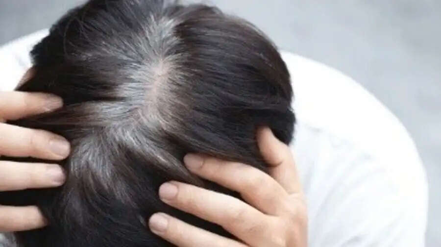 Hair Care Tips-&nbsp;क्या उम्र से पहले बाल सफेद होने लग गए है, तो शरीर में इस विटामिन की हो गई हैं कमी