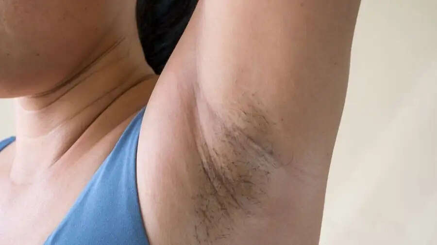 Under Arms Tips- क्या अंडरआर्म्स के कालेपन से शर्मिंदा होना पड़ता है, जानिए इसे हटाने के घरेलू उपाय