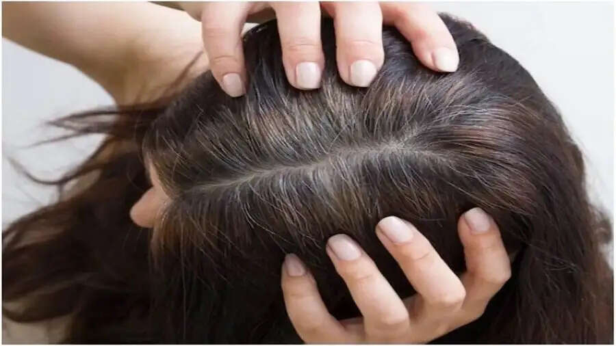 Hair Care Tips-&nbsp;क्या आप सफेद बालों से परेशान हैं, तो अपनाएं ये टिप्स