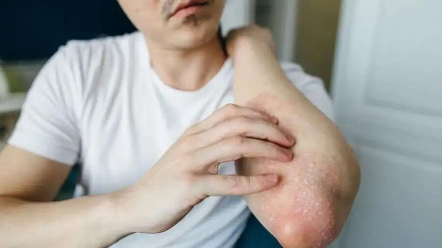 Health Tips- बारिश में भीगने से हो सकते हैं इन बीमारियों का शिकार, जानिए इनके बारे में