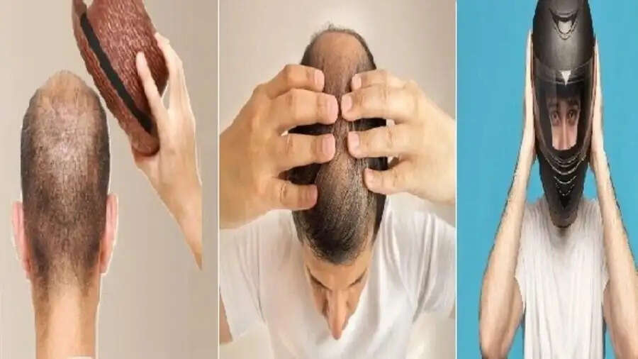 Hair Care Tips-&nbsp;क्या वाकई में हेलमेट पहनने से बाल झड़ते हैं, आइए जानें