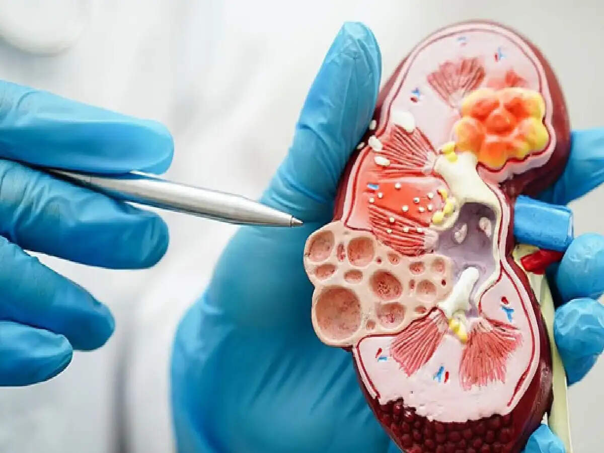 Kidney Damage Symptoms:क्या सुबह उठते ही आपको ये 5 बदलाव महसूस होते हैं? किडनी फेलियर के हैं लक्षण