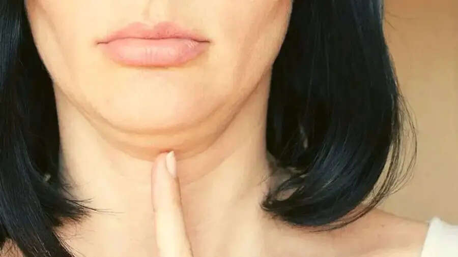 Skin Care Tips-&nbsp;क्या डबल चिन कि वजह से चेहरे की खूबसूरती बिगड़ गई है, जॉलाइन के लिए अपनाएं ये टिप्स