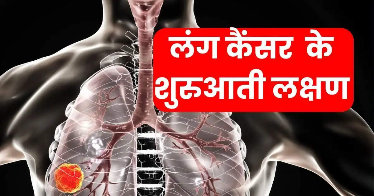 Health Tips- लंग्स कैंसर के ये होते हैं शुरुआती लक्षण, जानिए इनके बारे में