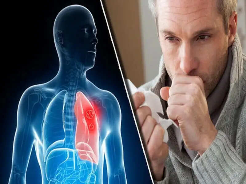 Health Tips- फेफड़ो में जमा हो गया हैं बलगम, साफ करने के लिए अपनाएं ये घरेलू नुस्खें